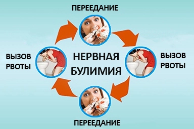 Лечение булимии в Десногорске